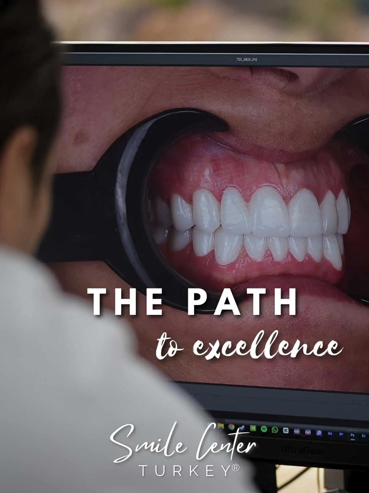 Behandler bei der Prüfung hochauflösender Dentalfotografien am Bildschirm bei Smile Center Turkey®