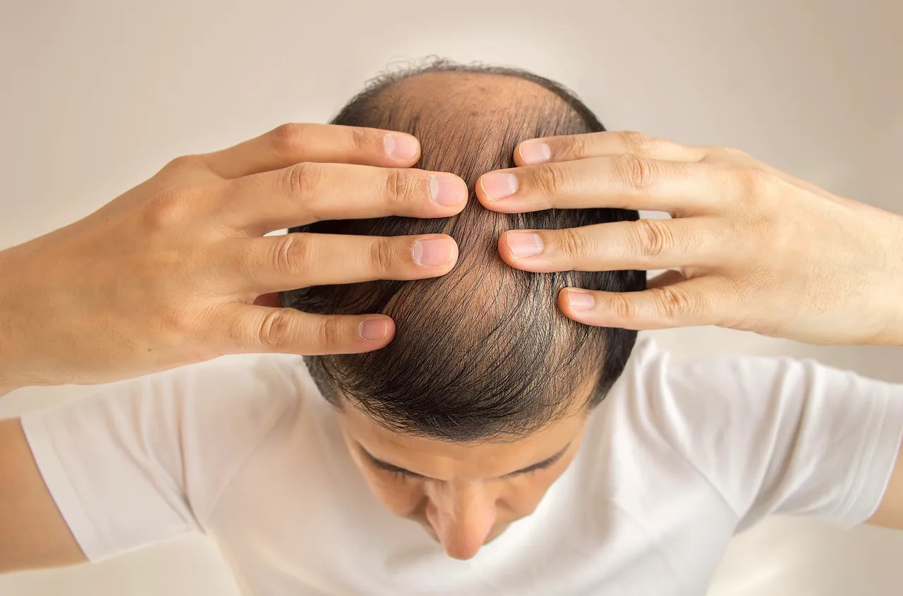 Ein potenzieller internationaler Patient bespricht die Planung einer Haartransplantation mit einer Fachperson in einem Beratungsgespräch.